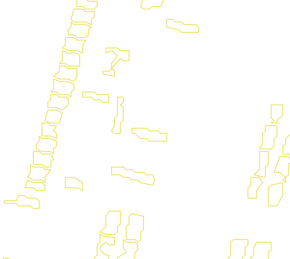 Daksegment met contourlijnen en structuurweergave